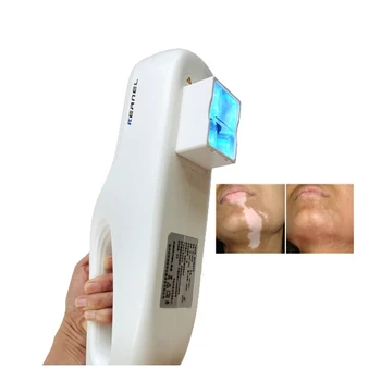 ליבה KN-5000E מיני 308 ננומטר excimer UV פוטותרפיה מכונת ויטיליגו טיפול בפסוריאזיס